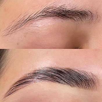 Browlifting Lashlifting